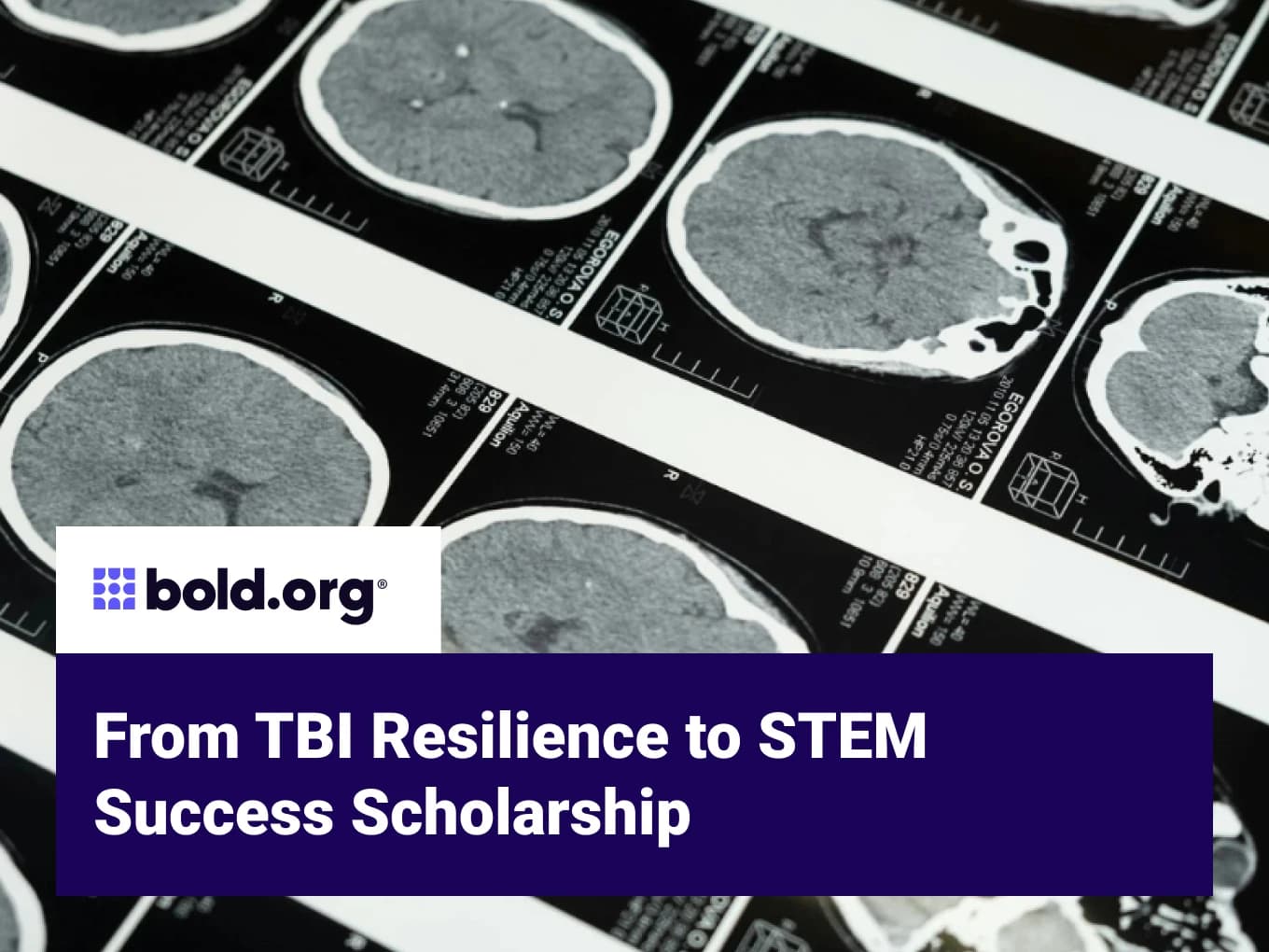 From TBI Resilience to STEM Success Scholarship